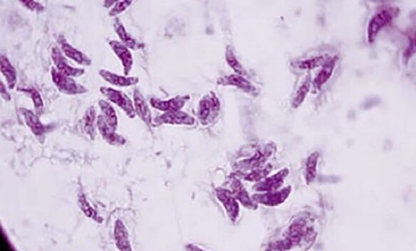 ký sinh đơn bào toxoplasma gondii tác nhân gây bệnh toxoplasma